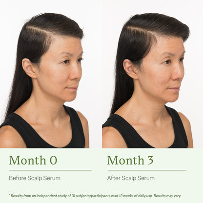 AuraRoot® - Advanced Scalp Serum